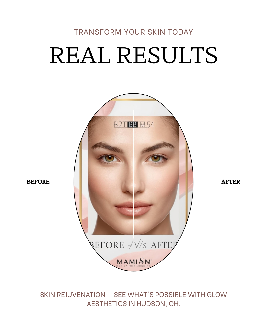 Glow Aesthetics - Real Results Before and After